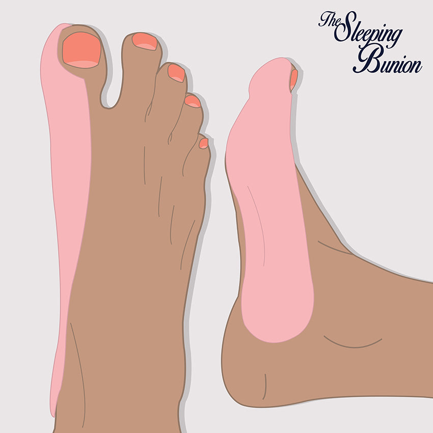 The Sleeping Bunion Pads ضمادات التورّم اللّيلية